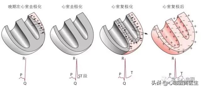 通俗易懂的心电图基础介绍，零基础都秒懂：学习心电图