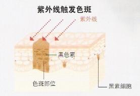 日光浴的危害到底有多大，日光浴不会变黑？会加速衰老