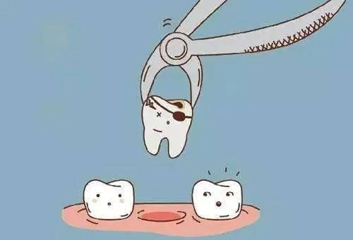 拔智齿后注意事项，正确拔牙后注意事项（医生：智齿就像“渣男”）