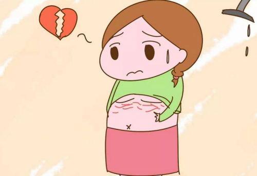 肥胖纹和妊娠纹区别(肥胖纹和妊娠纹图片)