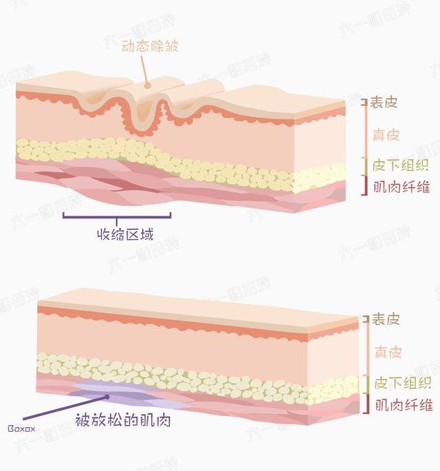 额头有皱纹怎么办，额头有皱纹眼睛下面也有皱纹