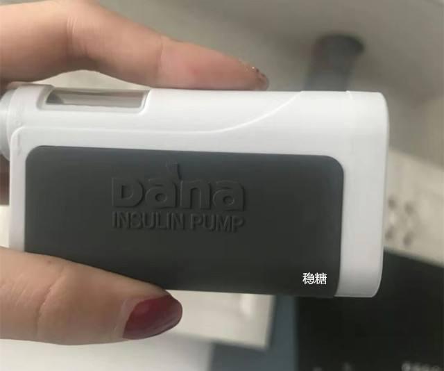 糖尿病泵进口(美国进口糖尿病自动泵)