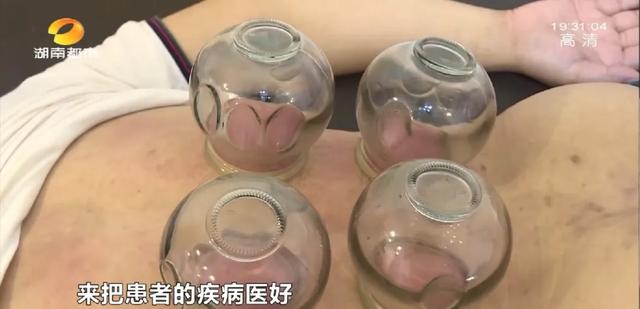 烫熨疗法配方，土还能治病800年传承