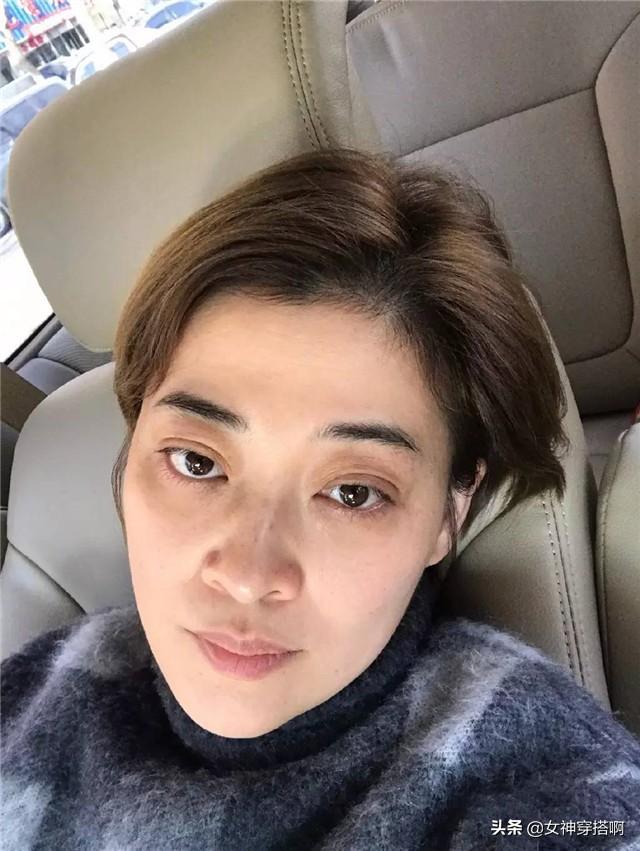 鼻子整容正面前后对比，被男生公认最丑的4种