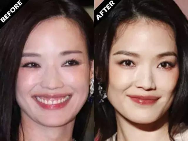 每一个人的脸长相都像明星，你喜欢那个明星的脸形