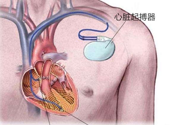环流器二号核聚变装置，中国环流器二号M装置预计今年建成