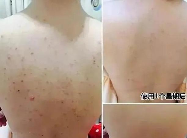 30岁女人正确护肤步骤，女人过了30岁别瞎打扮