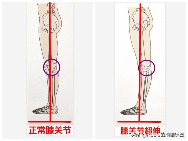 林允又傳新戀情？身材回春長腿耀眼，4步拯救膝超伸get同款美腿 健身減肥達人 第12张