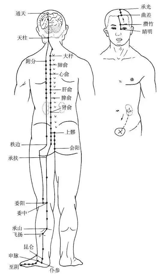 怎样按摩膀胱经，膀胱经自我疏通方法（医生：就1招）