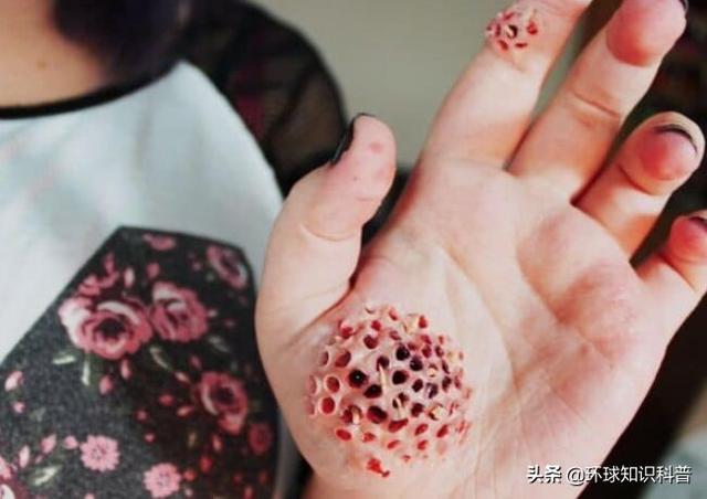 密集物体恐惧症，十种最奇异的恐惧症（人为什么会有密集物体恐惧症）