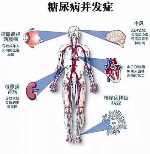 鼻咽癌加糖尿病(鼻咽癌加糖尿病好治疗么)