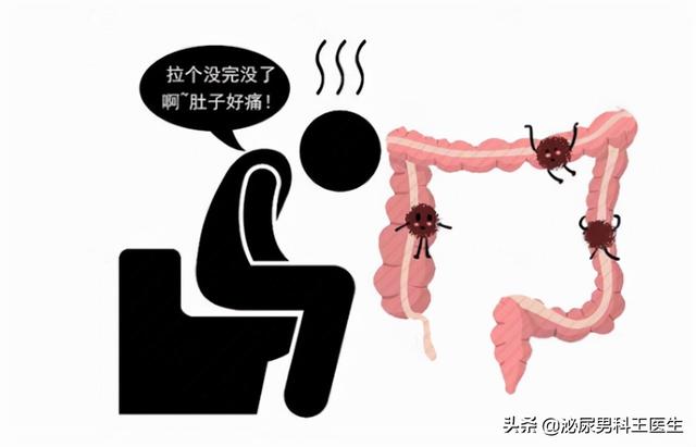 什么情况下要人造肛门，我国“造口人”超百万