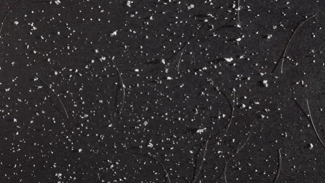 腿上有白色的皮屑，冬天腿上有白色的皮屑