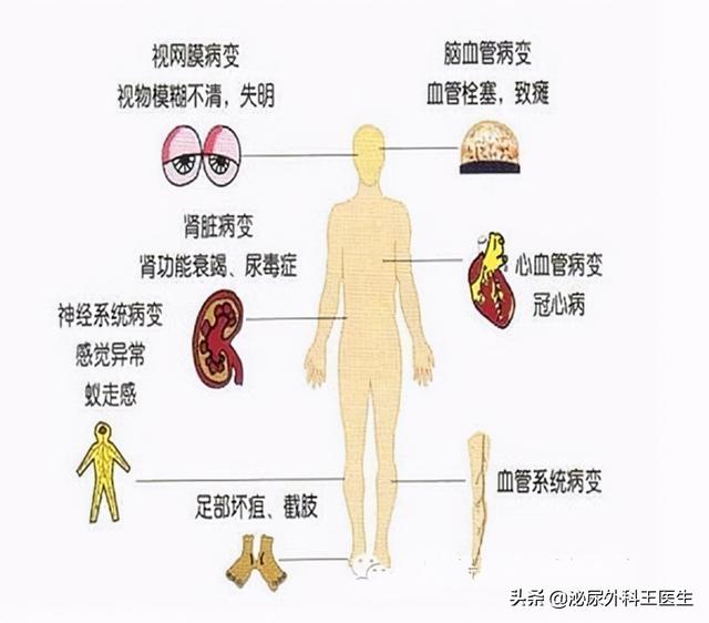 糖尿病并发症瘙痒(糖尿病并发症瘙痒吃什么药)