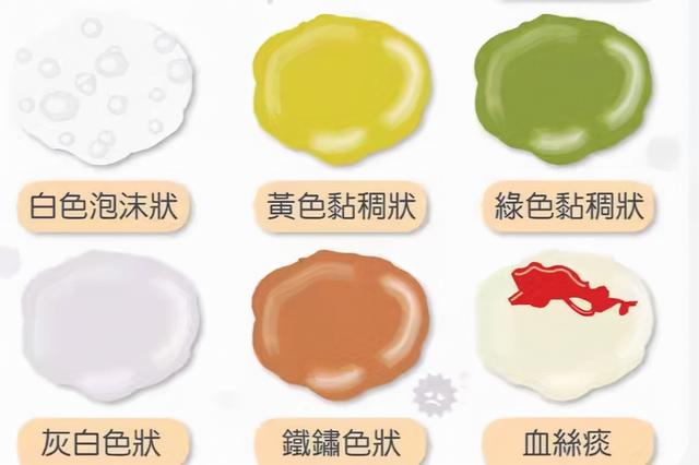 肺炎咳痰示意图，根据痰液颜色分辨肺炎类型