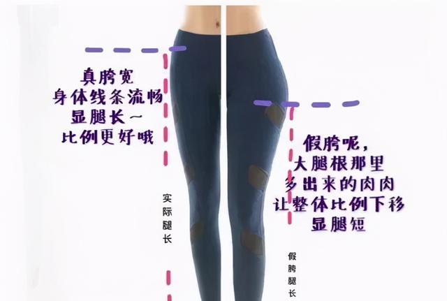 修正肥胖纹(肥胖纹用什么药膏可以使用)