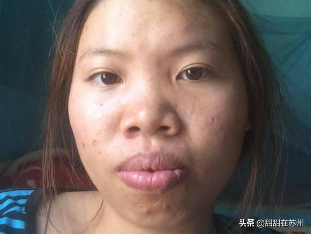 男人眼中的十大丑女，异性眼中的丑女