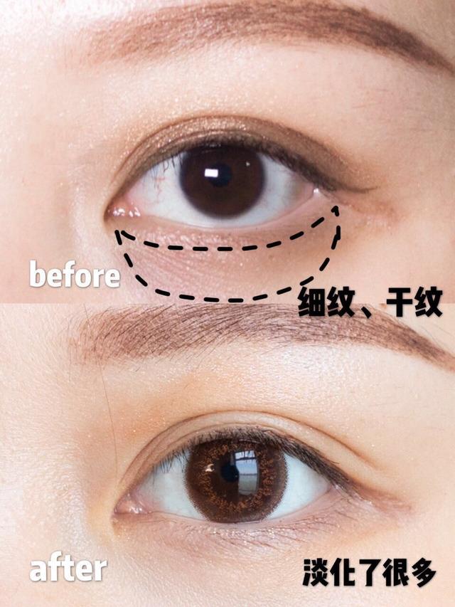 欧莱雅紫熨斗眼霜，欧莱雅紫熨斗眼霜正确使用方法（欧莱雅紫熨斗眼霜使用步骤）