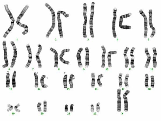 正常人类的染色体数量，科学家最新发现