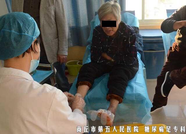 糖尿病足4级治疗(糖尿病足4级怎么治)