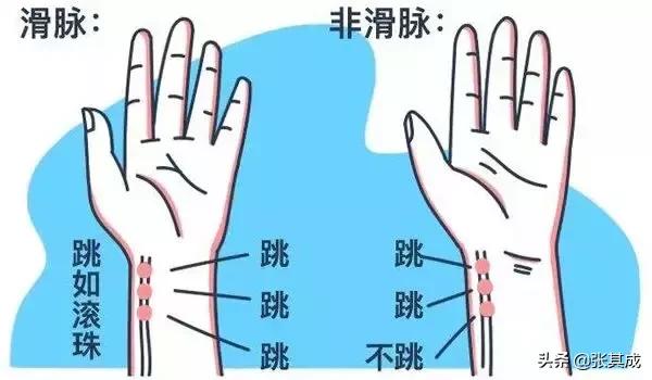怎样辨别27种脉象，辨别八种重要脉象