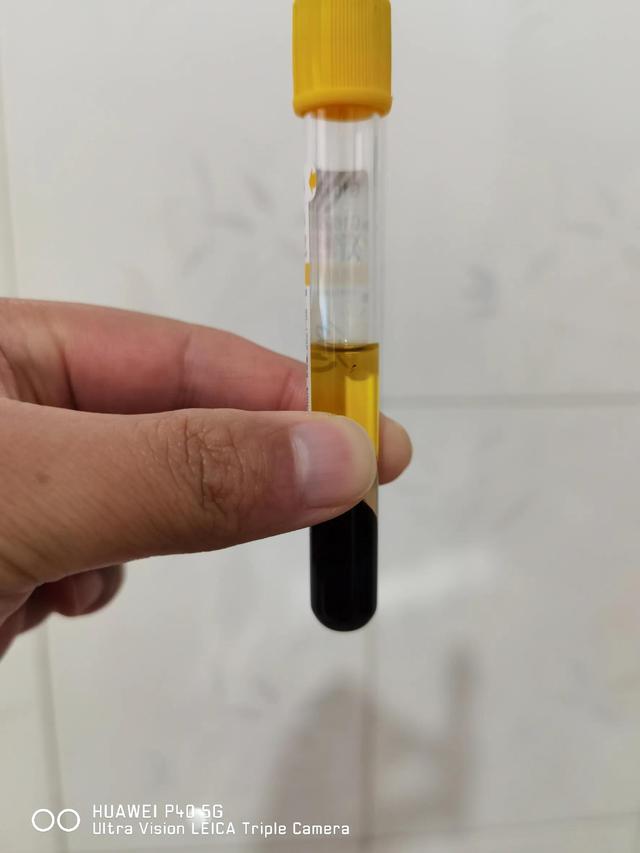 血液和血浆的区别，血浆跟血液有什么不同（可能都是吃出来的）