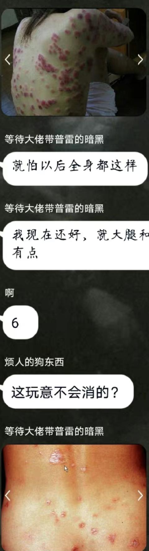 梅毒变肥胖(梅毒患者会发胖吗)