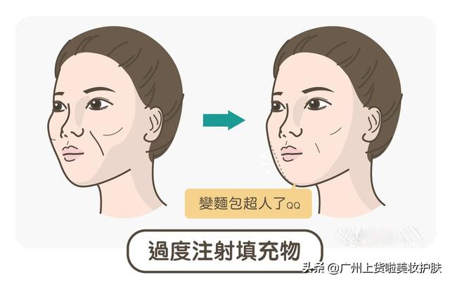 真正能改善法令纹的办法，法令纹显老10岁