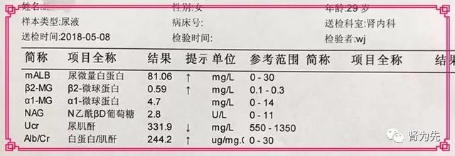 尿苷糖尿病(尿糖有哪些症状)