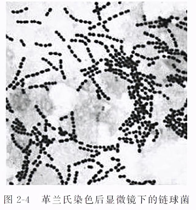 嗜热链球菌是什么食品添加剂，记住这个数字，给娃挑选真酸奶