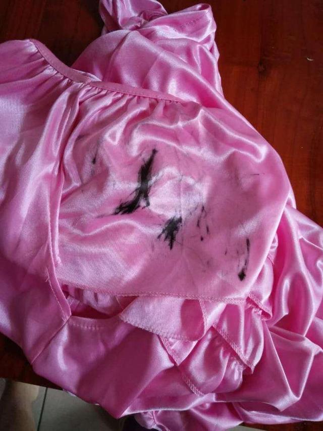 衣服上的顽固污渍怎么去除，衣服上顽固污渍怎么去除