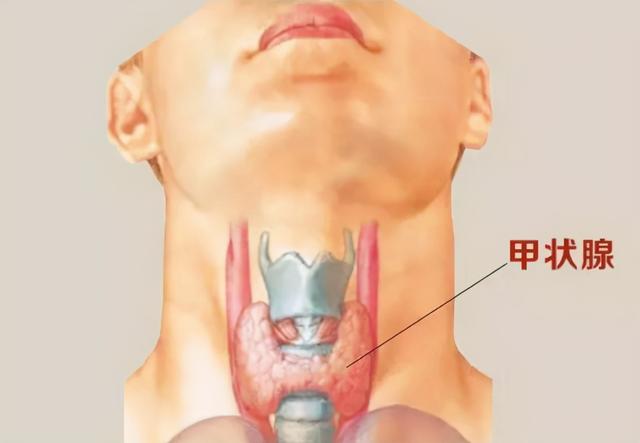 甲状腺结节会肥胖吗(甲状腺结节会肥胖肚子大吗图片)