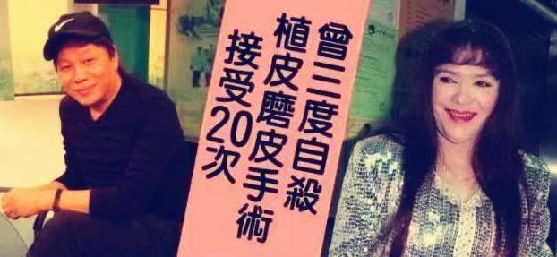 梁小龙秃头吗，被迫跟着我爹看了12遍