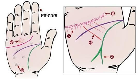 面诊图解大全清晰图，手诊面诊全息图解（你也能当半个医生）