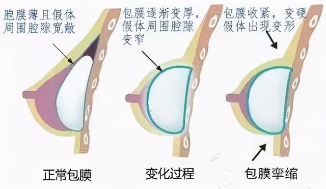 女朋友的胸，为什么忽大忽小？ 情人节送女朋友礼物