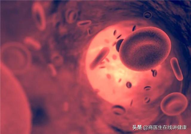 机制性肥胖(机制臃肿)