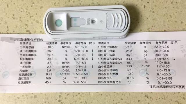辟謠：給狗狗多吃肉它們的營養才能更豐富？小心發生胰腺炎 萌趣萌寵 第7张