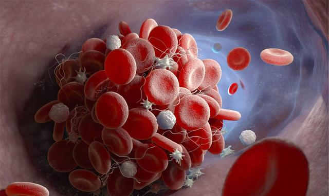 常见的血液病有哪些，血液病出现有这6大症状