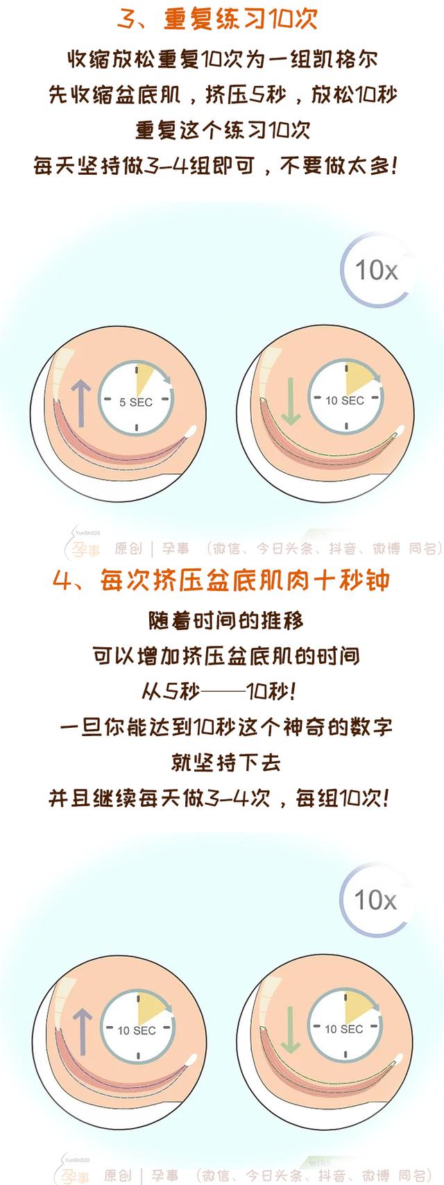 凯格尔运动方法，凯格尔运动，你做对了吗