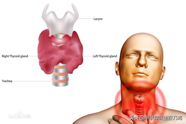 甲状腺肿大分级，甲状腺肿大每一度分级代表什么