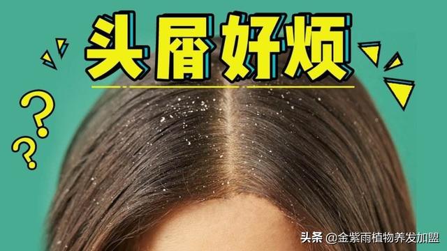 最简单快速去除头皮屑，简单快速去除头屑的小妙招（清理头屑的四个小妙招）