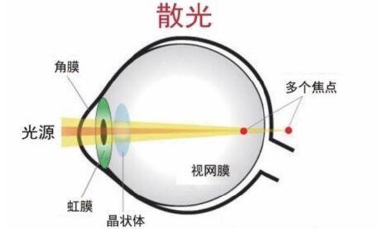 眼睛验光单怎么看，眼科验光检查报告单怎么看（1分钟带你看懂报告单）