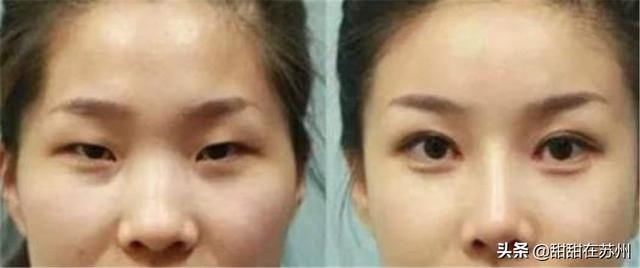 男人眼中的十大丑女，异性眼中的丑女