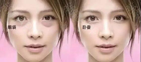 去黑眼圈的土方法，去眼袋黑眼圈最有效的土方法