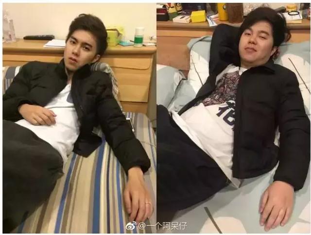 肥胖p(肥胖皮肤发黑是什么原因引起的)