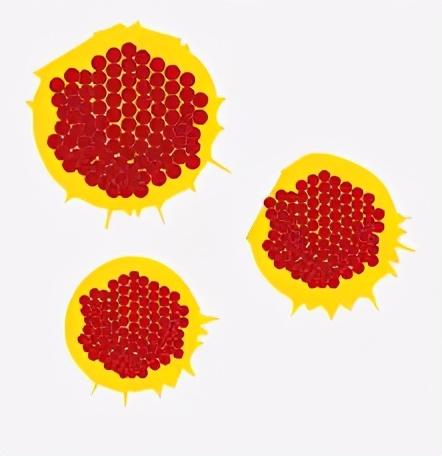 女性生殖器疱疹，为什么生殖器疱疹一直都隐隐作痛（生殖器疱疹究竟有多可怕）