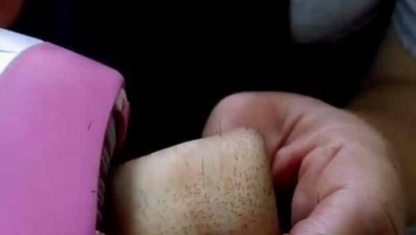 猪皮上的毛怎么去掉，猪皮上的猪毛怎样快速有效的去除
