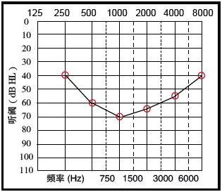 如何看听力图，教你学会看听力图