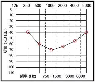 如何看听力图，教你学会看听力图