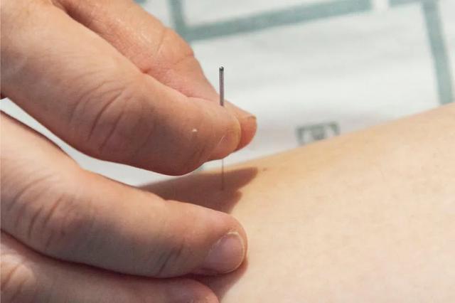 扎针的几种针法，二十六种针灸手法
